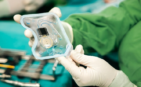 A világ első okos cochleáris implantátumát egy magyar kisfiú kapta Szegeden